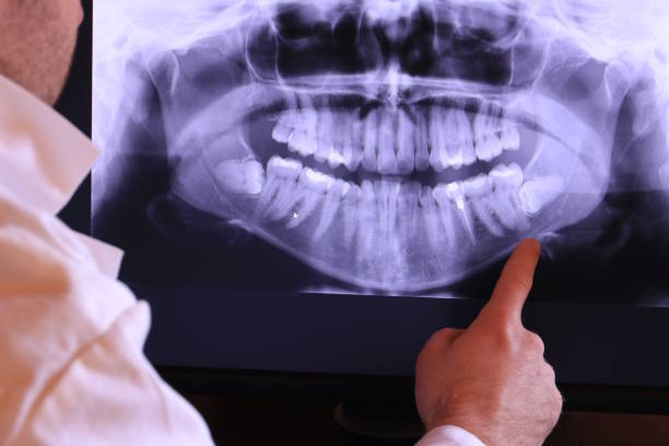 Best Emergency Dental Care for Sports Injuries in Velva, ND